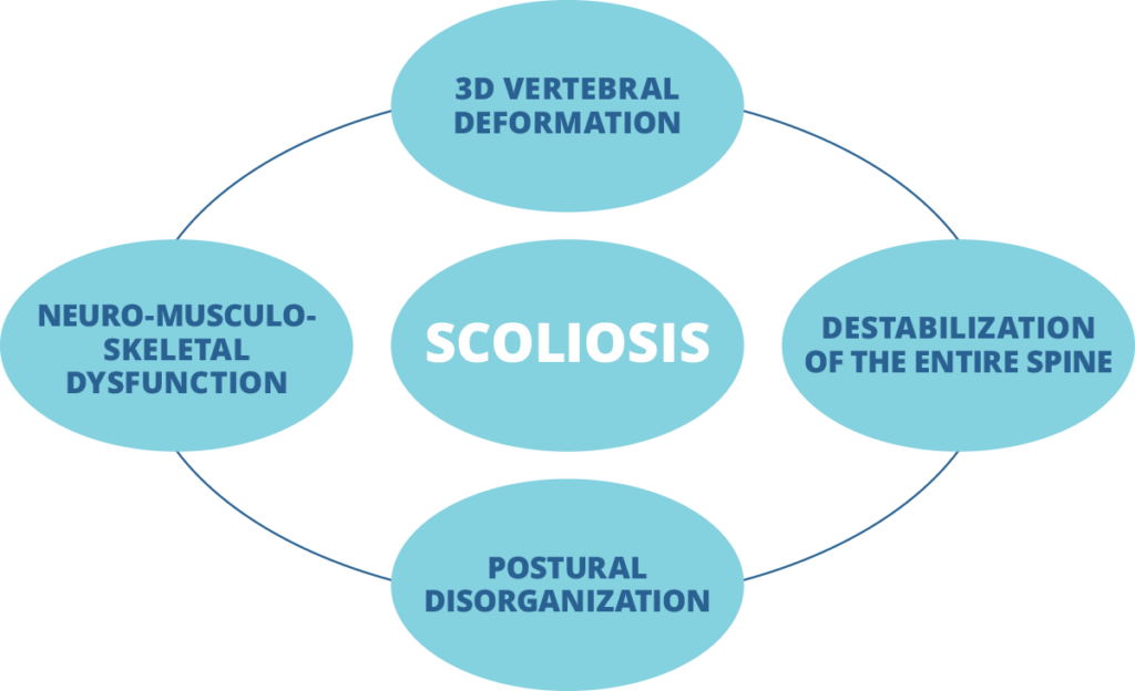What is Scoliosis? – SpineCor Scoliosis Bracing Toronto